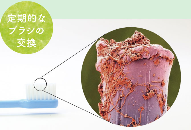 歯ブラシの汚れ